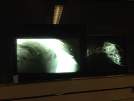 Röntgenbild Lya